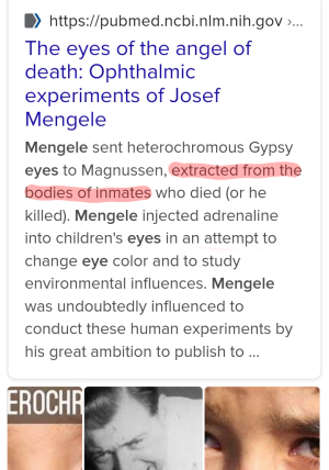 Mengeleeyedye1.png